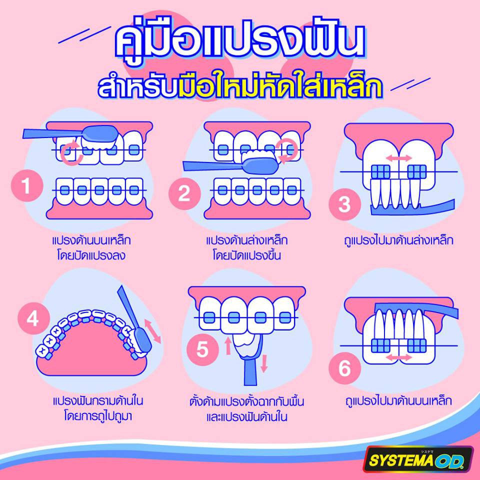 [ยกลัง] Systema OD Glow แปรงสีฟัน สำหรับคนจัดฟัน ซิสเท็มมา โอดี ด้ามเรืองแสง 48 ชิ้น